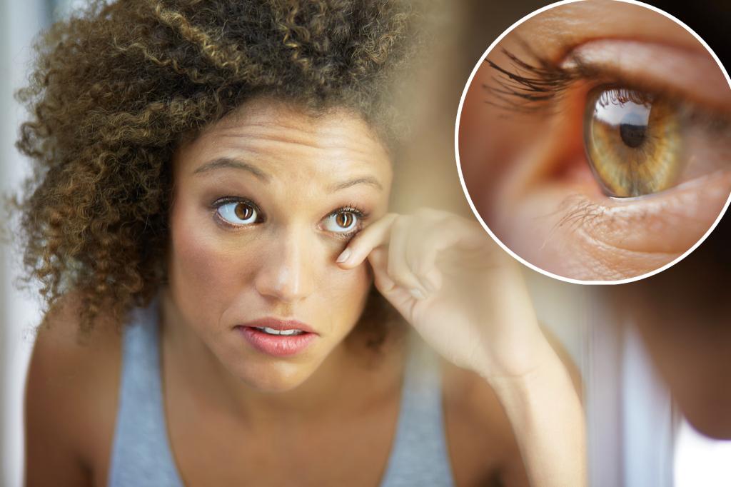 It’s ‘eyelash-shedding season’ — common symptoms and risks
