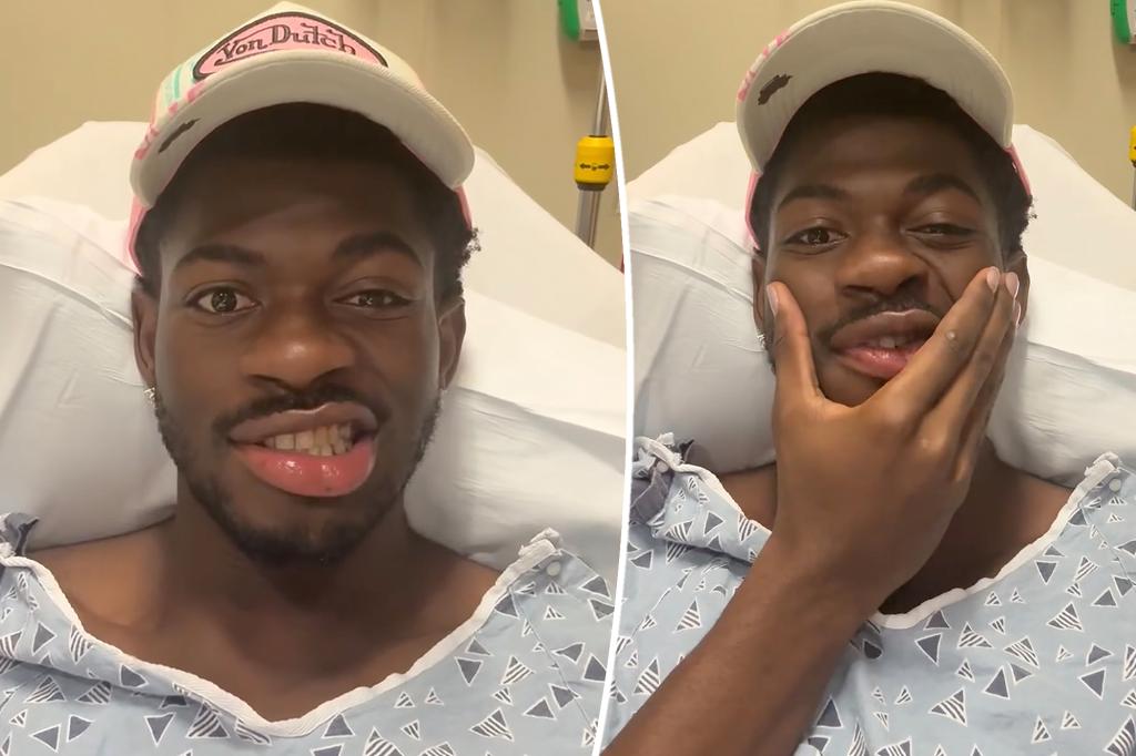 Lil Nas X hospitalized after losing control of side of face