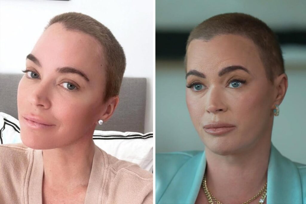 Teddi Mellencamp Admits She’s “Really Scared” As She Reveals “50/50” Chance Of Surviving Stage 4 Cancer